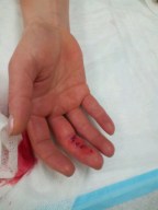 The Sausage Finger Diet, and other Crazy Ideas | Feminist Figure ...