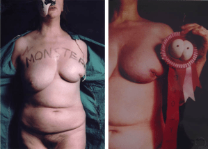 Jo Spence and Tim Sheard, Exiled (left), from the series Naarratives of Dis-ease (1989).