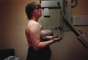 Contemporary artist Jo Spence refused passivity during her mammogram by producing her own pictures of the process (from her series The Picture of Health? 1982-86) 